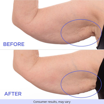 Liftéa™ Sculpt & Tone Arm Cream